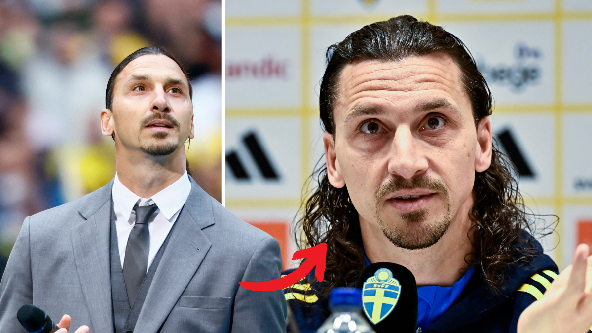 Zlatan Ibrahimovic har fåt en otäck skallskada. 